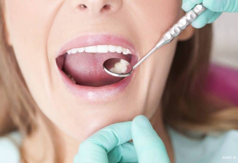 Retrouvez un sourire éclatant recoller une dent avec résine ou colle — free download