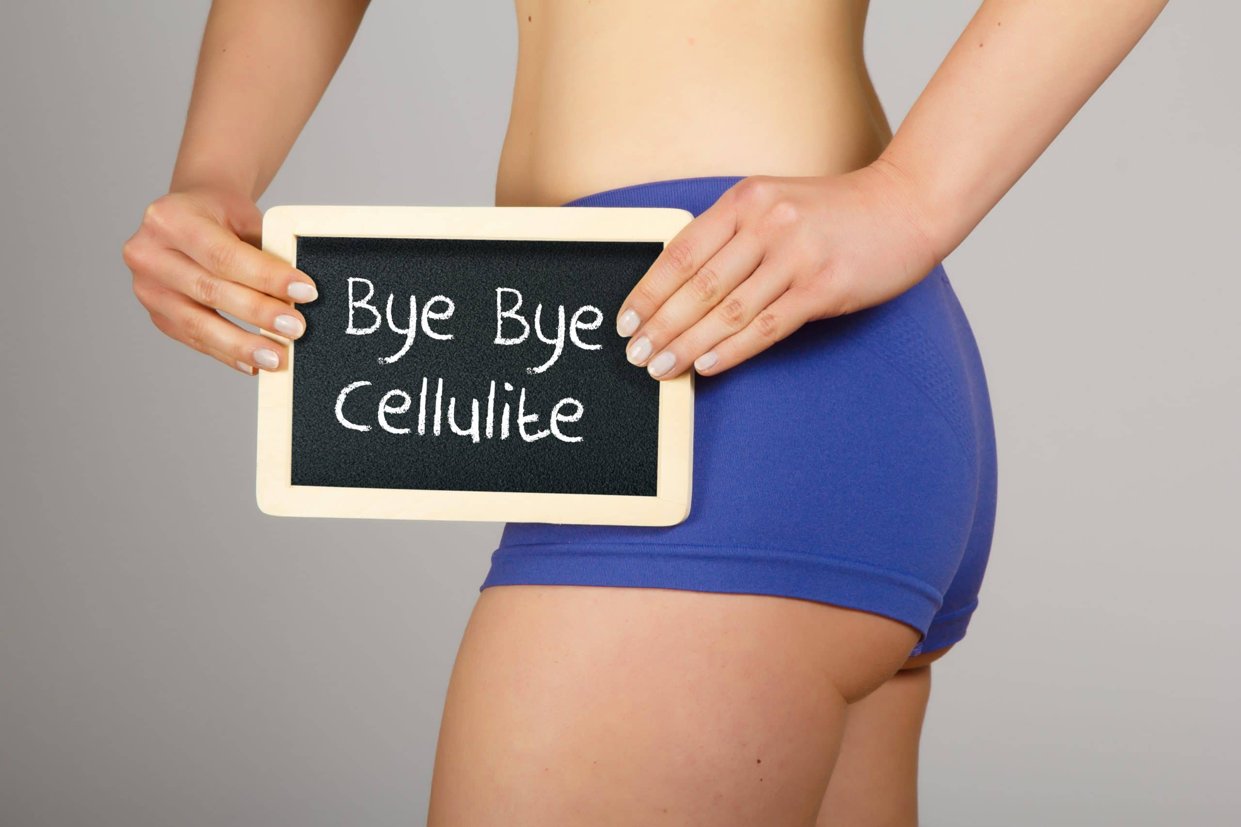 Les différents types de cellulite et comment s'en débarrasser ?