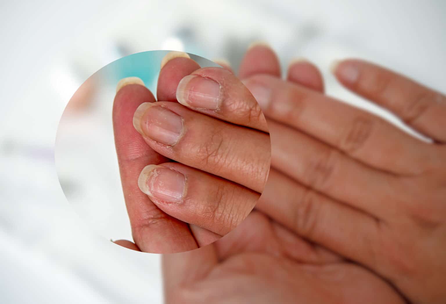 Réparez vos ongles en gel abimés avec nos astuces professionnelles — free download